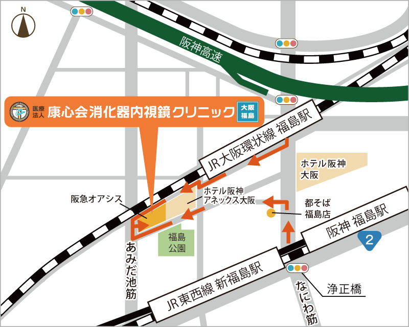 アクセス 大阪市の胃カメラ 大腸カメラは康心会消化器内視鏡クリニック大阪福島院 痛くない 苦しくない 麻酔を使った胃カメラ 大腸カメラ 大阪府大阪市 Jr大阪環状線福島駅